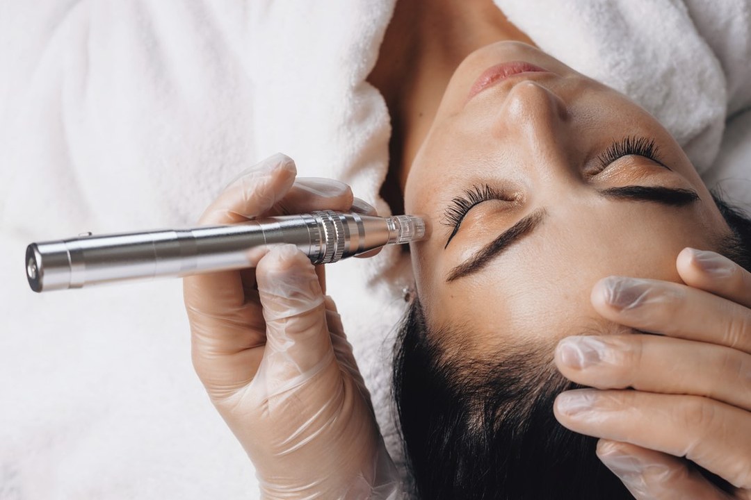 Microneedling-Behandlung mit Pen-Gerät bei Medaesthetics
